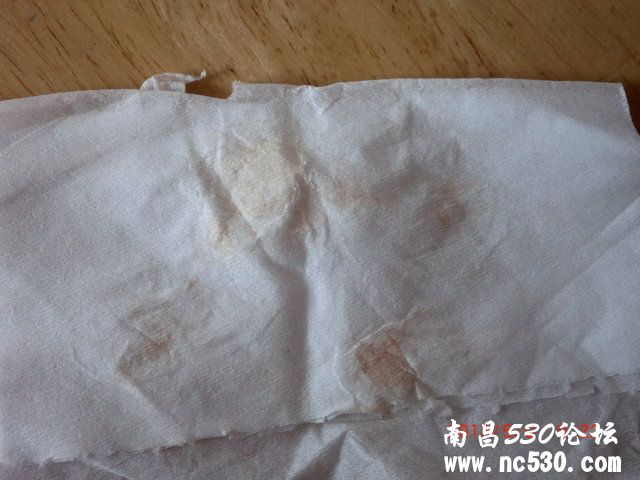 母狗绝育后阴道分泌物有血丝一个月